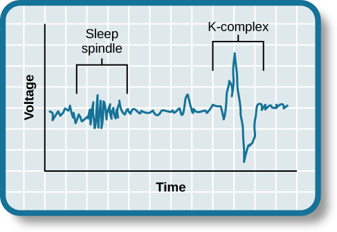 A graph has an x-axis labeled “time” and a y-axis labeled “voltage. A line illustrates brainwaves, with two areas labeled “sleep spindle” and “k-complex”. The area labeled “sleep spindle” has decreased wavelength and moderately increased amplitude, while the area labeled “k-complex” has significantly high amplitude and longer wavelength.
