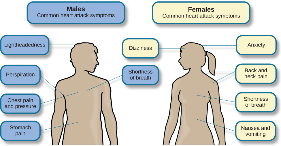 A figure showing outlines of the male and female bodies indicates common heart attack symptoms for each sex. For males, these include lightheadedness, perspiration, chest pain and pressure, stomach pain, and shortness of breath. For females, these include dizziness, anxiety, back and neck pain, shortness of breath, nausea and vomiting.