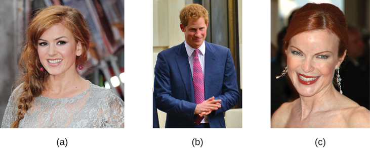 Photograph A shows Isla Fischer. Photograph B shows Prince Harry. Photograph C shows Marcia Cross.